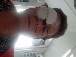 Ich habe heute meine 2. AugenOP machen lassen. Und auch heute habe ich0